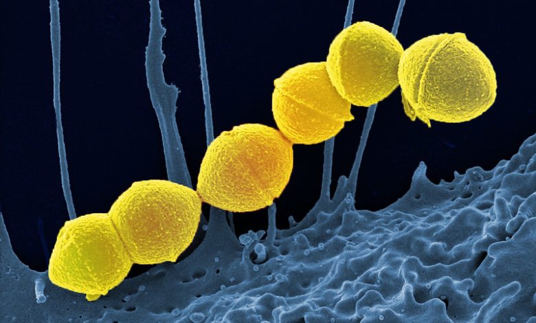 Gambar Invasive Group A Strep. Sumber: Twitter UK Health Security Agency