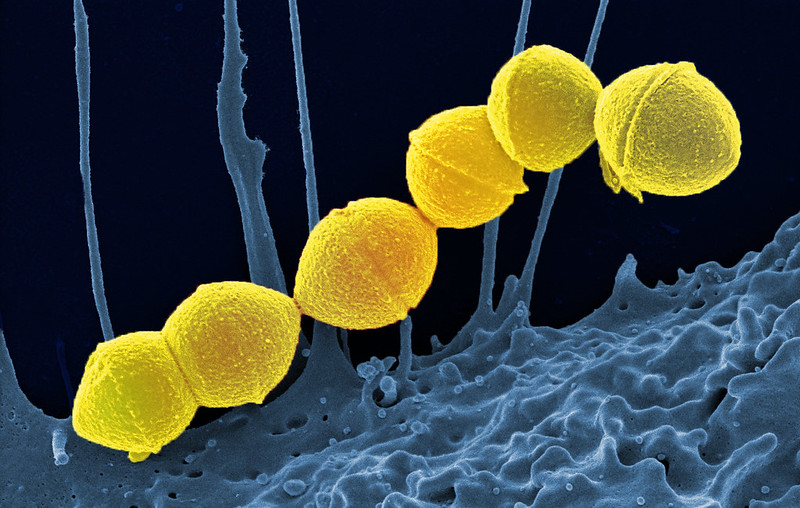 Gambar Invasive Group A Strep. Sumber: Twitter UK Health Security Agency